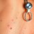 Dermatolog – kluczowe informacje o chorobach skóry i profilaktyce