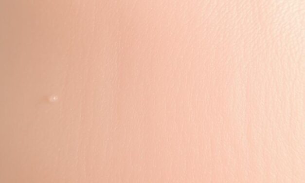 Kwas salicylowy na zaskórniki – skuteczny sposób na piękną skórę